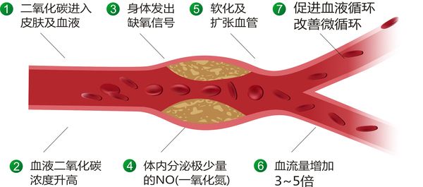碳酸泉作用流程.jpg