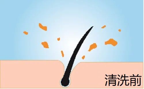 前.jpg